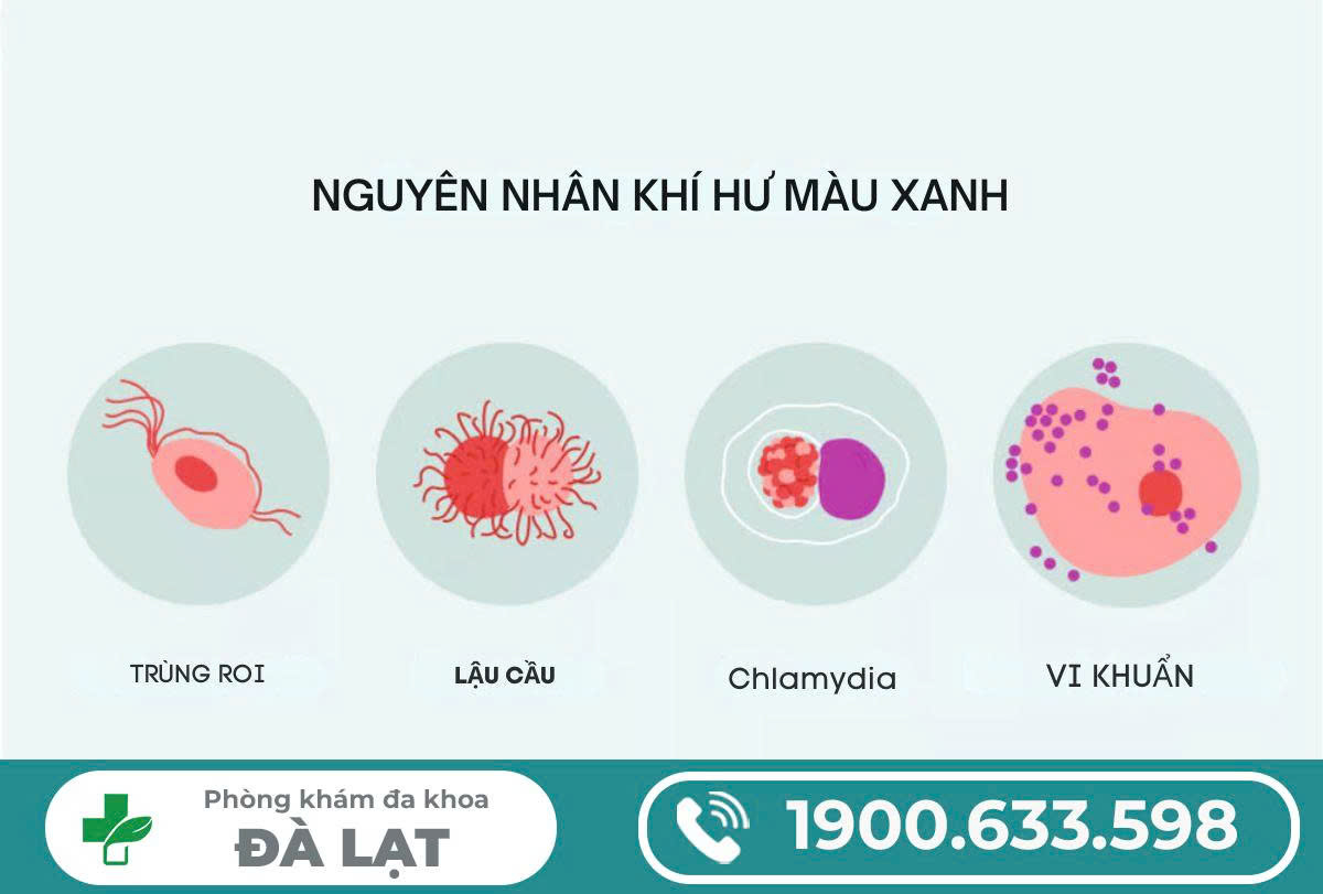 Hình ảnh minh họa